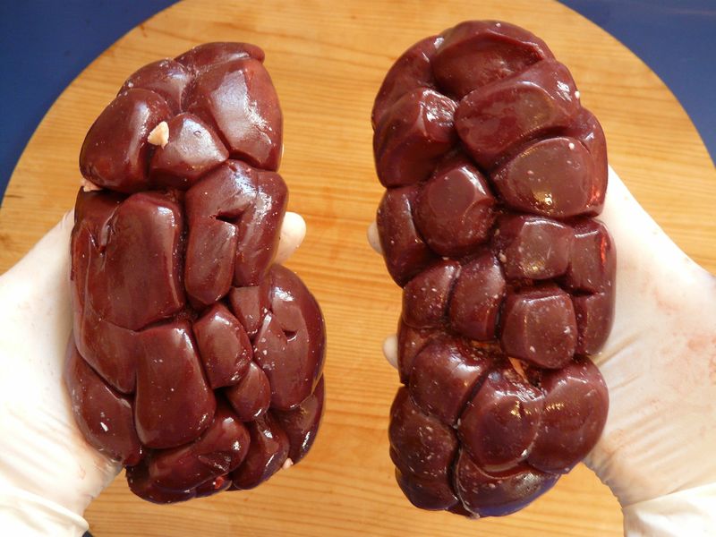 Les rognons de boeuf crus constituent une excellente source de protéines, car ils en contiennent 15, 3 grammes pour une portion de 100 grammes de cet aliment.